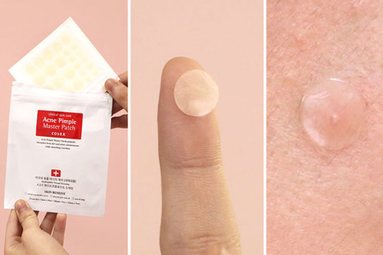 Are Pimple Patches Good For Your Skin