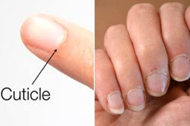 15 Ways To Take Care Of Dry Cuticles Heal Them Hergamut